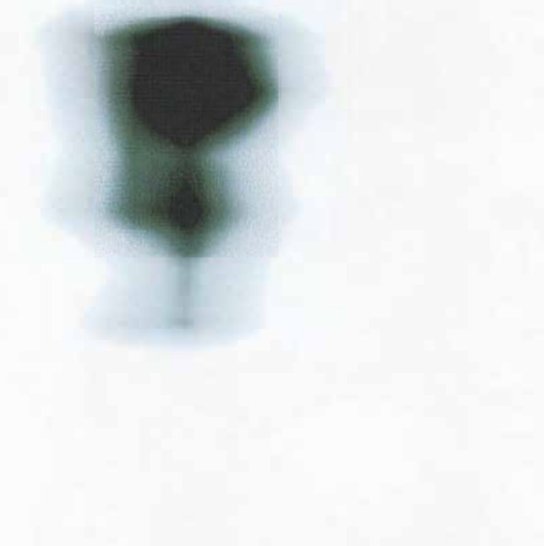 Enhanced, blurry image of an object, possibly L-shaped or with protrusions.