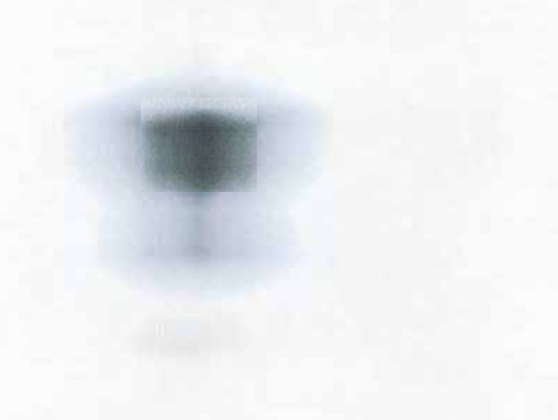 Second enhanced, blurry image of an object, appearing somewhat symmetrical with a central column.